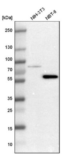 LIM kinase 2 Antibody, Novus Biologicals:Antibodies:Primary Antibodies